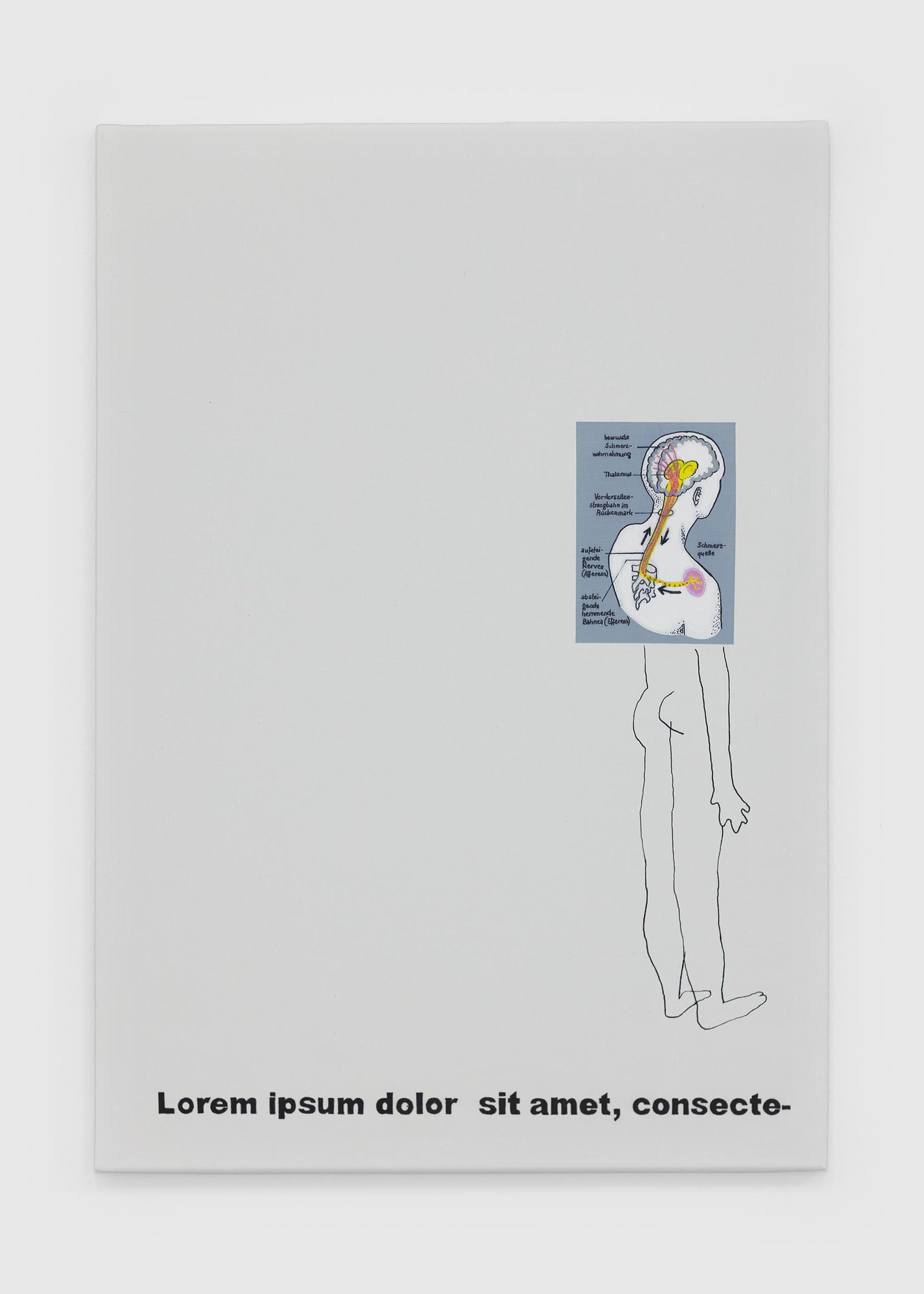 Marta Vovk, The Painy Brainy, Galerie Falko Alexander